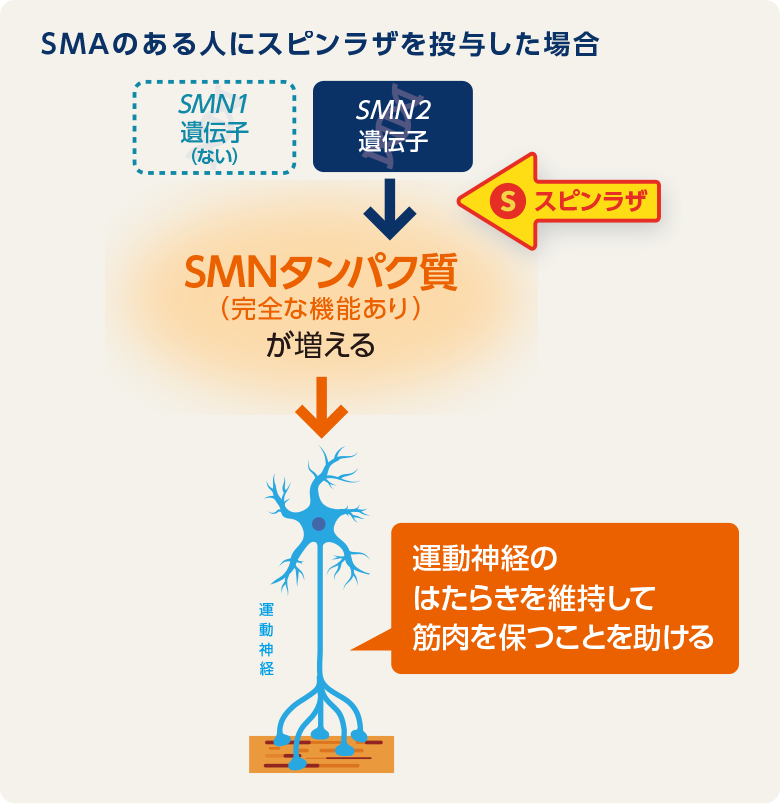 SMAのある人にスピンラザを投与した場合