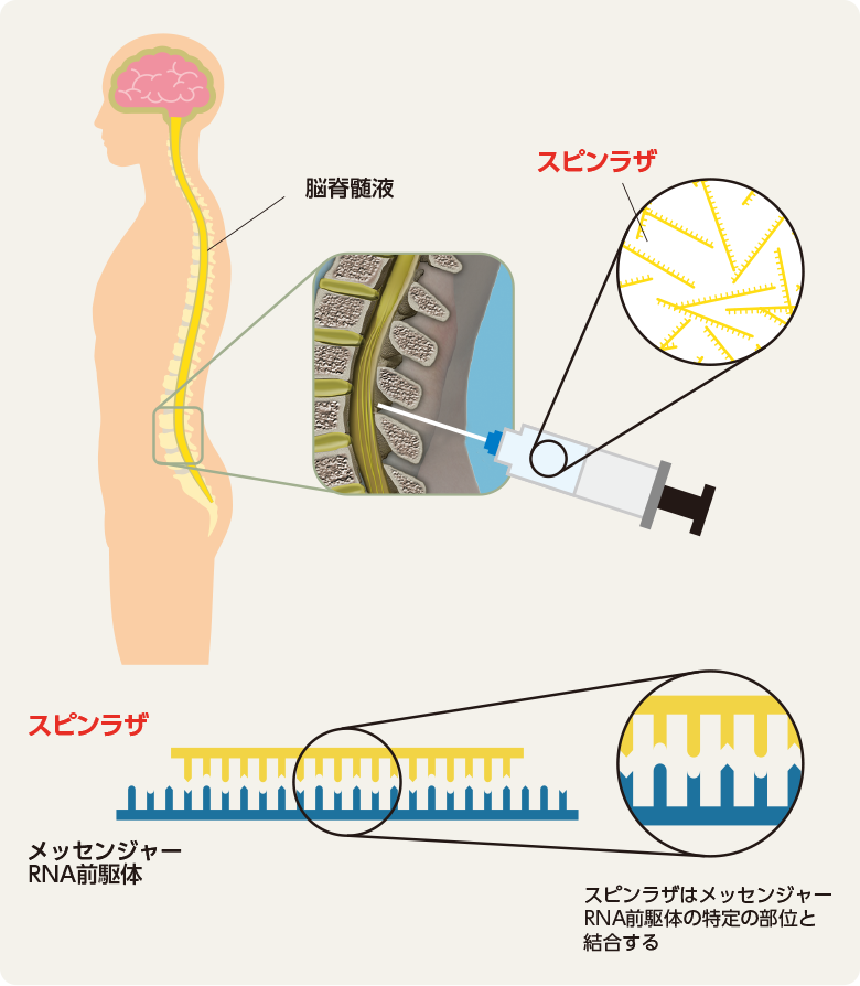 スピンラザの作用